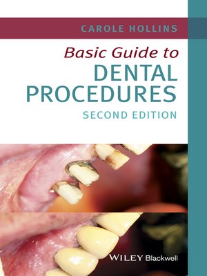 cover image of Basic Guide to Dental Procedures